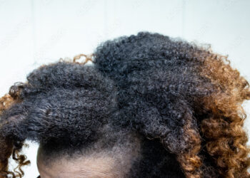 3 Products That’ll Keep Your Scalp From Acting A Dry, Flaky Fool Underneath Your Weaves and Wigs