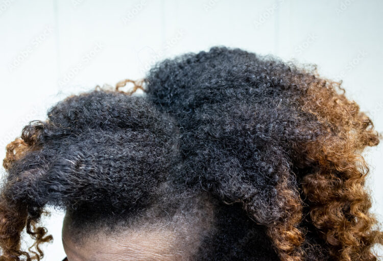 3 Products That’ll Keep Your Scalp From Acting A Dry, Flaky Fool Underneath Your Weaves and Wigs