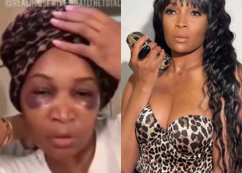 Marlo Hampton Shares Her Hair Transplant Journey, Says She Documented The Entire Thing