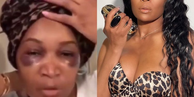 Marlo Hampton Shares Her Hair Transplant Journey, Says She Documented The Entire Thing