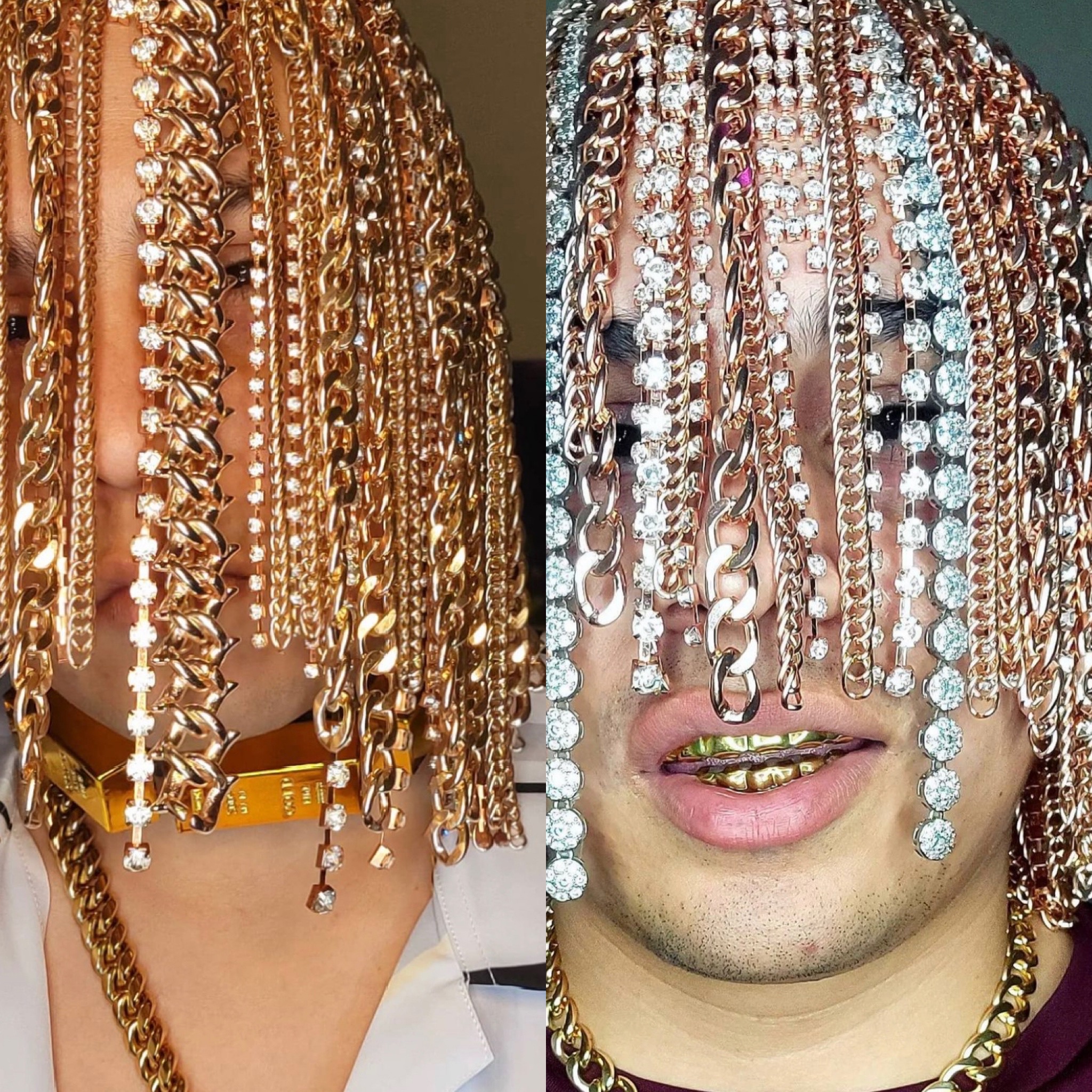 Gold Rush: Rapper Dan Sur Replaces Hair With Surgically Implanted Gold  Chains
