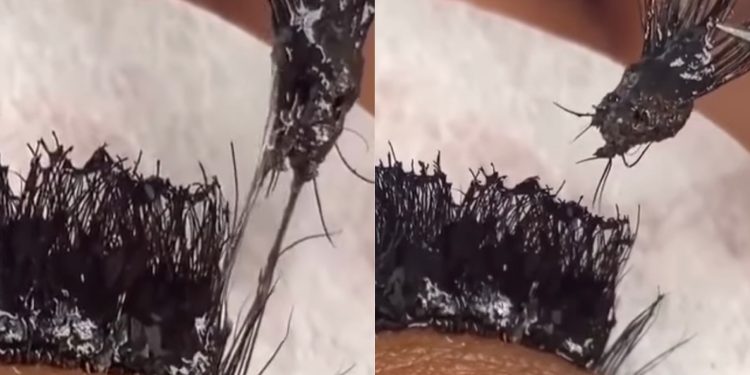This TikTok Account Is Exposing Bad Lash Extension Practices – Client Had Hair Glue And Lash Extension Glue On Lashes