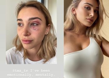 Camaryn Swanson, Tyga’s Ex Girlfriend Is Accusing Him Of Domestic Abuse, He Is Cooperating With Police