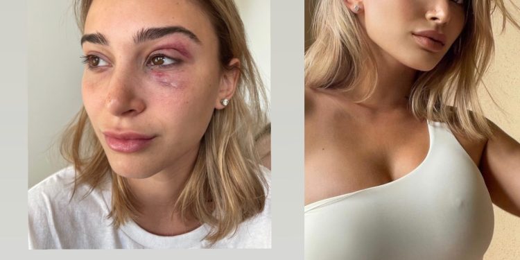 Camaryn Swanson, Tyga’s Ex Girlfriend Is Accusing Him Of Domestic Abuse, He Is Cooperating With Police