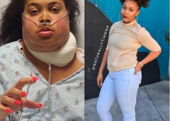 Naturalista And Fitness Enthusiast Shares Her Survivor Story And Inspires Instagram