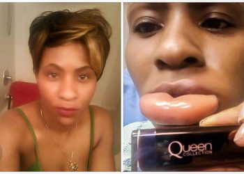 Woman Has Horrible Allergic Reaction To The Cover Girl Queen Collection Lipstick
