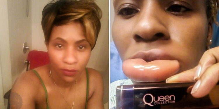 Woman Has Horrible Allergic Reaction To The Cover Girl Queen Collection Lipstick