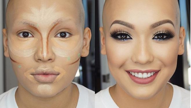 Young Girl With Traction Alopecia Gets An Amazing Makeover For Prom