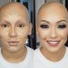 Young Girl With Traction Alopecia Gets An Amazing Makeover For Prom