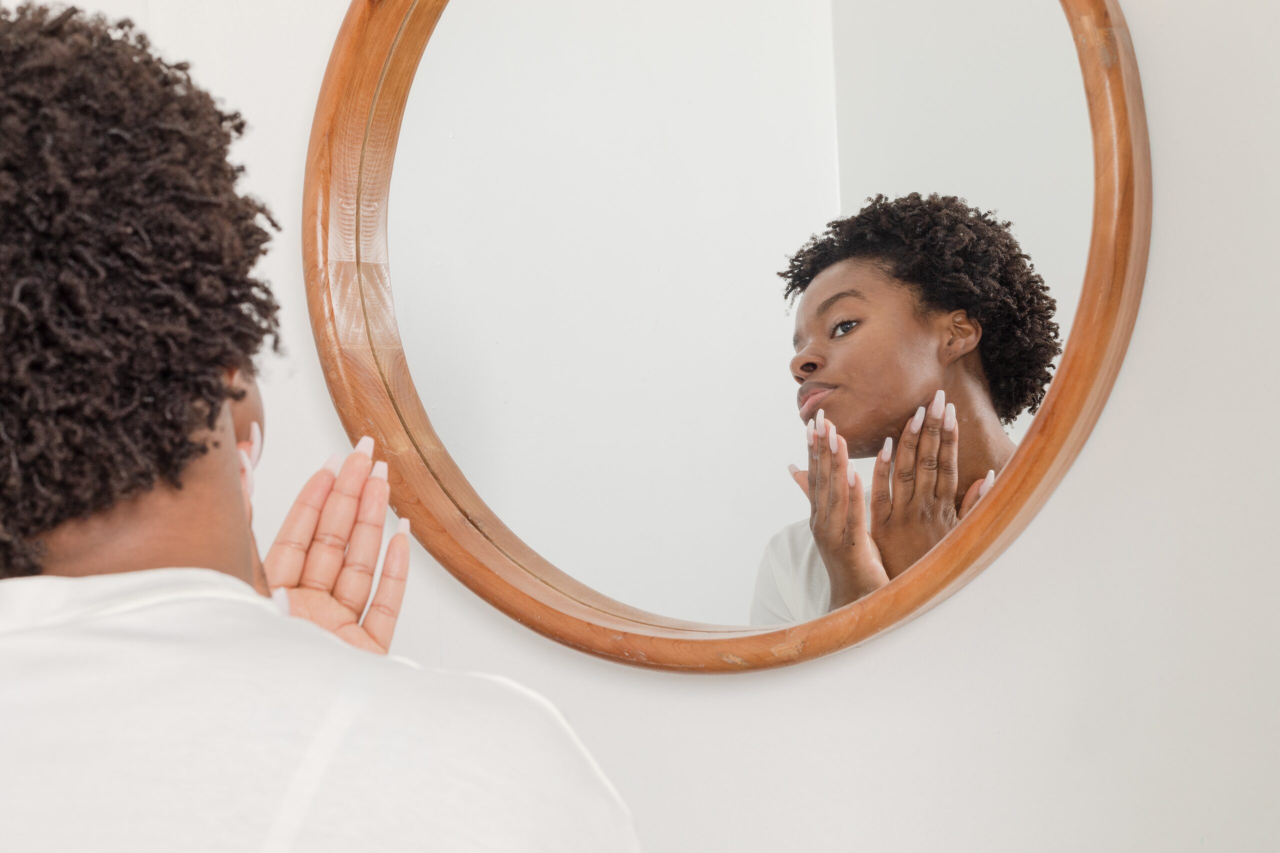 Black woman healing acne scars