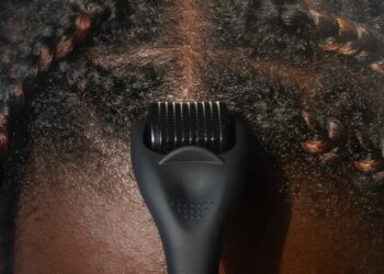 dermarolling hairline