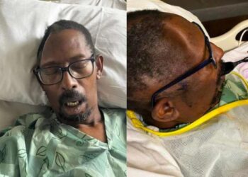 man sues hospital for losing his skull