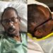 man sues hospital for losing his skull